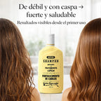 Gota Dourada – Champú Fortalecedor Anticaspa con Ajo para Cabello Débil 430ml